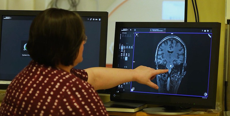 A researcher points at a brain scan in the Auburn University Neuroimaging Center