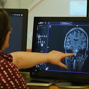 A researcher points at a brain scan in the Auburn University Neuroimaging Center
