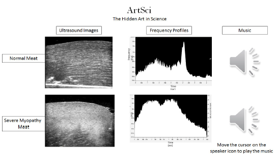 ULTRASOUND IMAGES